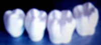 fila di denti